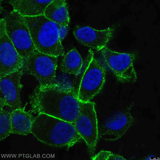 EPCAM Antibody in Immunocytochemistry (ICC/IF)