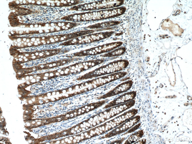 EPCAM Antibody in Immunohistochemistry (Paraffin) (IHC (P))