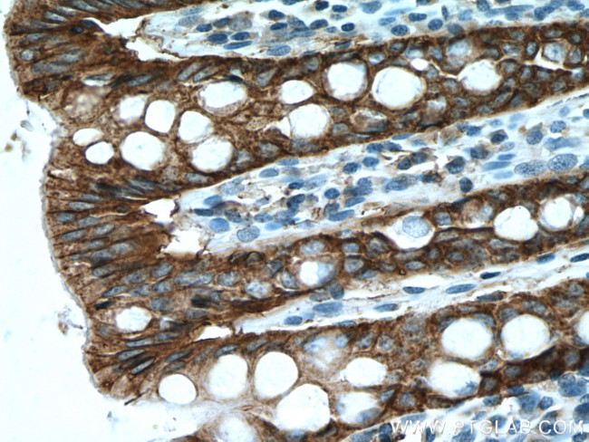 EPCAM Antibody in Immunohistochemistry (Paraffin) (IHC (P))