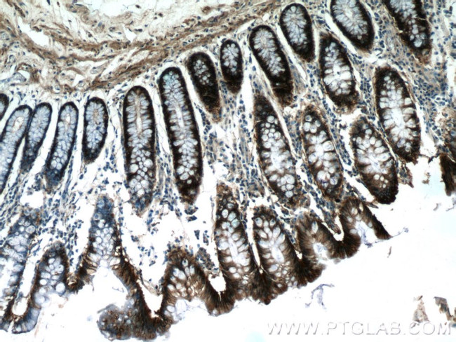 EPCAM Antibody in Immunohistochemistry (Paraffin) (IHC (P))