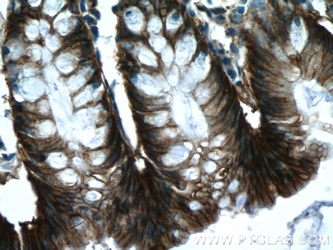 EPCAM Antibody in Immunohistochemistry (Paraffin) (IHC (P))