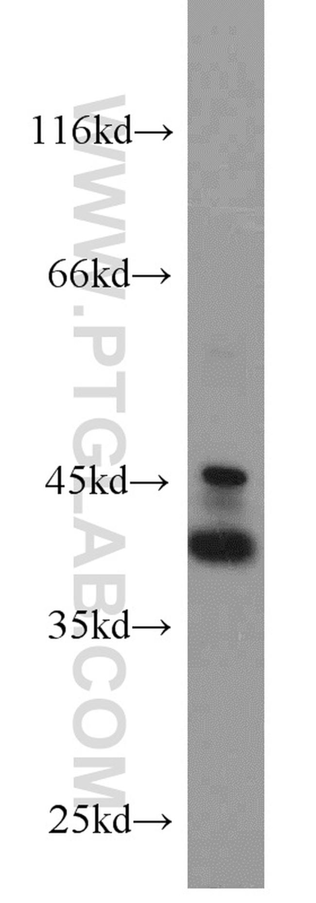 EPCAM Antibody in Western Blot (WB)