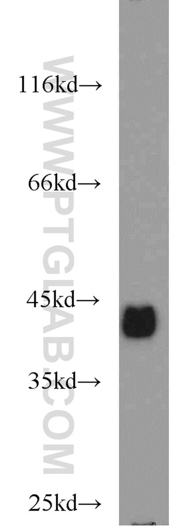 EPCAM Antibody in Western Blot (WB)