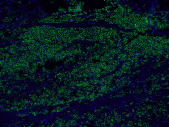 EPCAM Antibody in Immunohistochemistry (PFA fixed) (IHC (PFA))