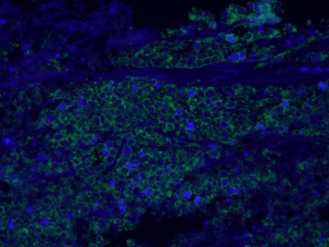 EPCAM Antibody in Immunohistochemistry (PFA fixed) (IHC (PFA))