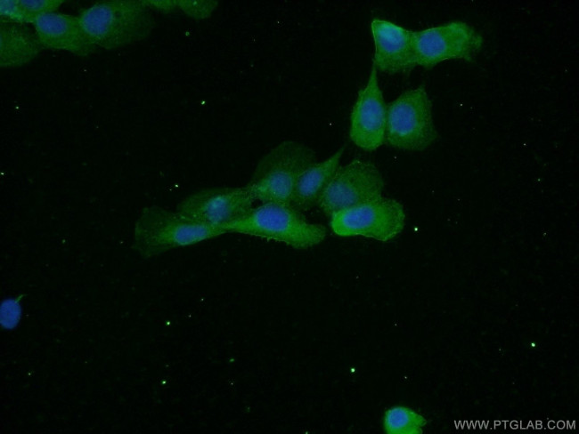 EPCAM Antibody in Immunocytochemistry (ICC/IF)