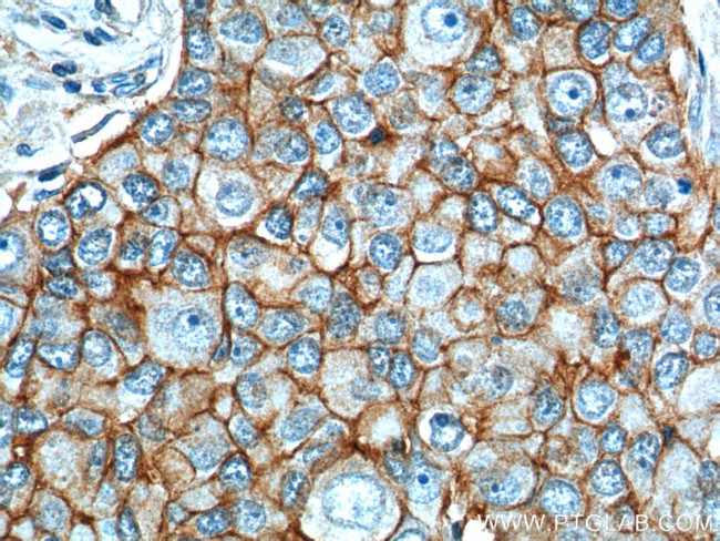 EPCAM Antibody in Immunohistochemistry (Paraffin) (IHC (P))