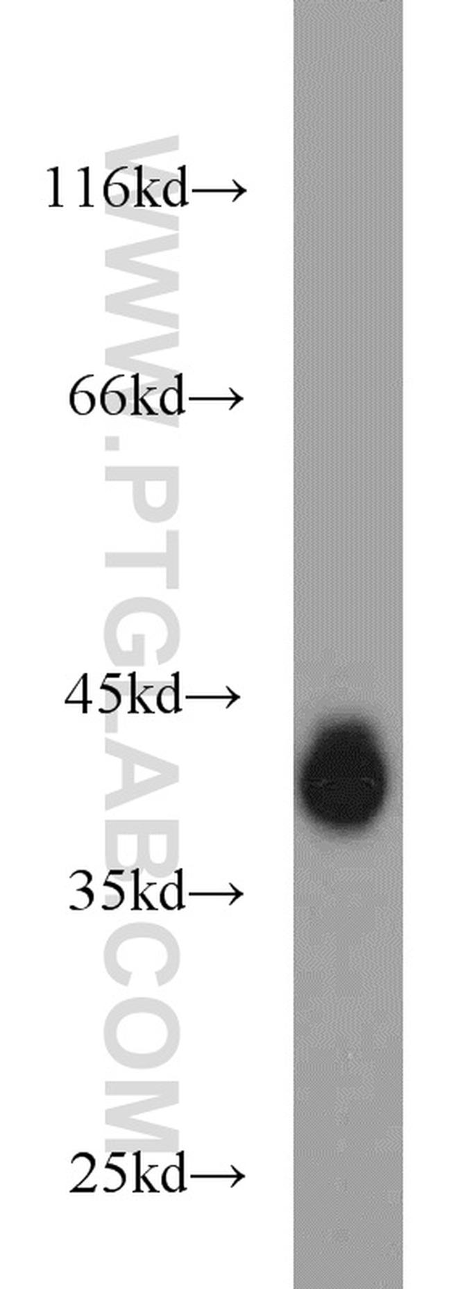 EPCAM Antibody in Western Blot (WB)