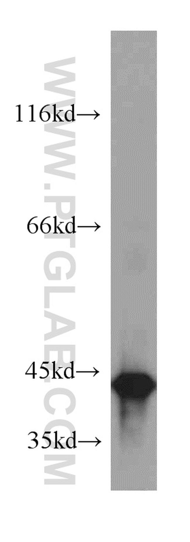 OXA1L Antibody in Western Blot (WB)