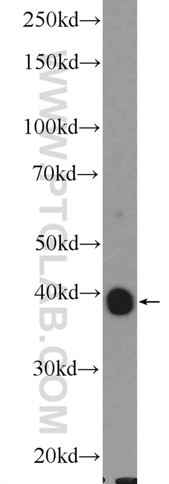 OXA1L Antibody in Western Blot (WB)