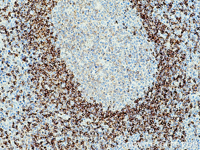 CD79B Antibody in Immunohistochemistry (Paraffin) (IHC (P))