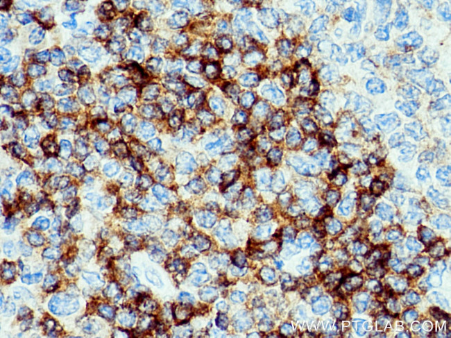 CD79B Antibody in Immunohistochemistry (Paraffin) (IHC (P))