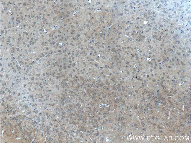 Synaptopodin Antibody in Immunohistochemistry (Paraffin) (IHC (P))