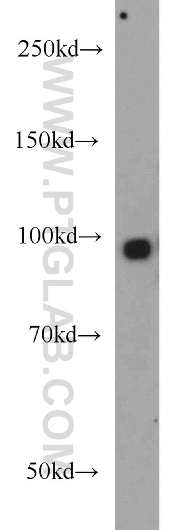 Synaptopodin Antibody in Western Blot (WB)