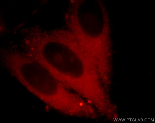 Synaptopodin Antibody in Immunocytochemistry (ICC/IF)