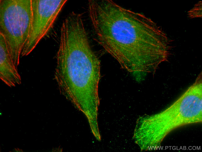 MLKL Antibody in Immunocytochemistry (ICC/IF)