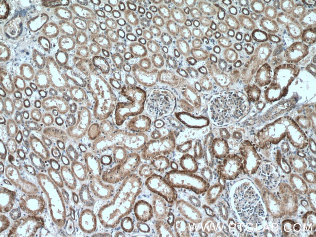 MLKL Antibody in Immunohistochemistry (Paraffin) (IHC (P))