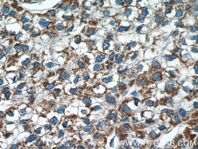 MLKL Antibody in Immunohistochemistry (Paraffin) (IHC (P))