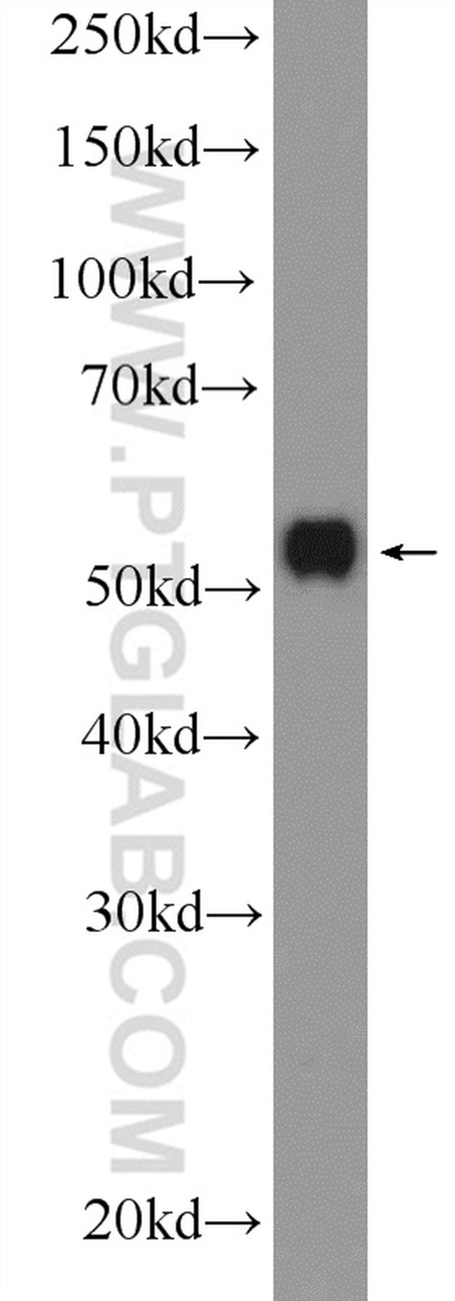 MLKL Antibody in Western Blot (WB)