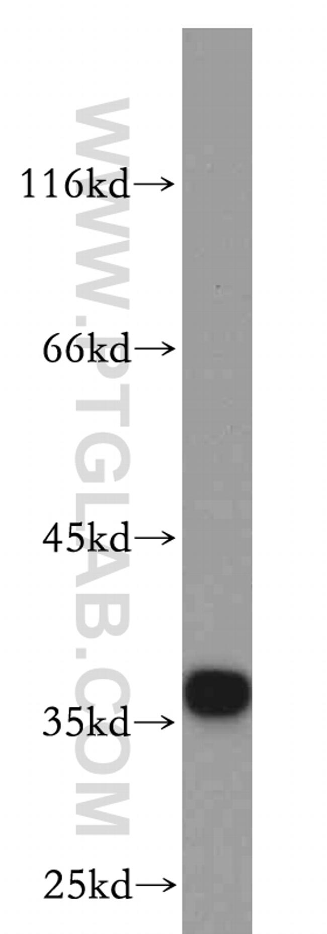 CNN2 Antibody in Western Blot (WB)