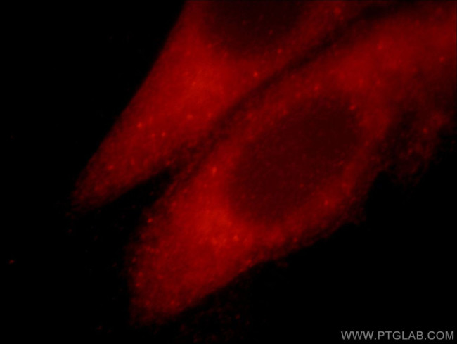 TRIM54 Antibody in Immunocytochemistry (ICC/IF)