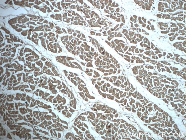 TRIM54 Antibody in Immunohistochemistry (Paraffin) (IHC (P))