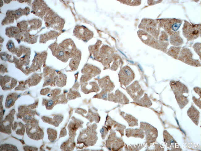 TRIM54 Antibody in Immunohistochemistry (Paraffin) (IHC (P))