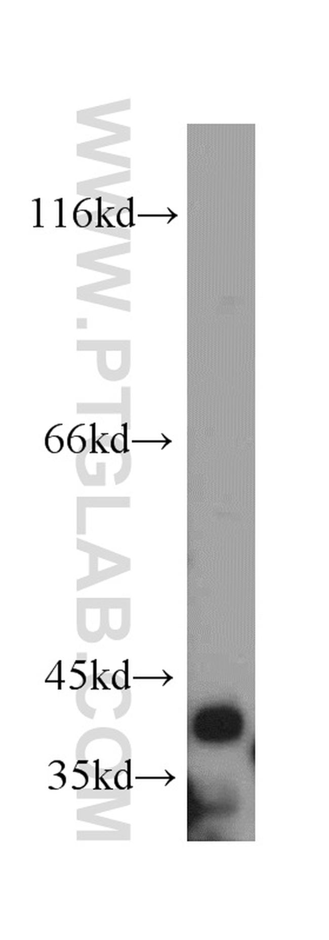 TRIM54 Antibody in Western Blot (WB)