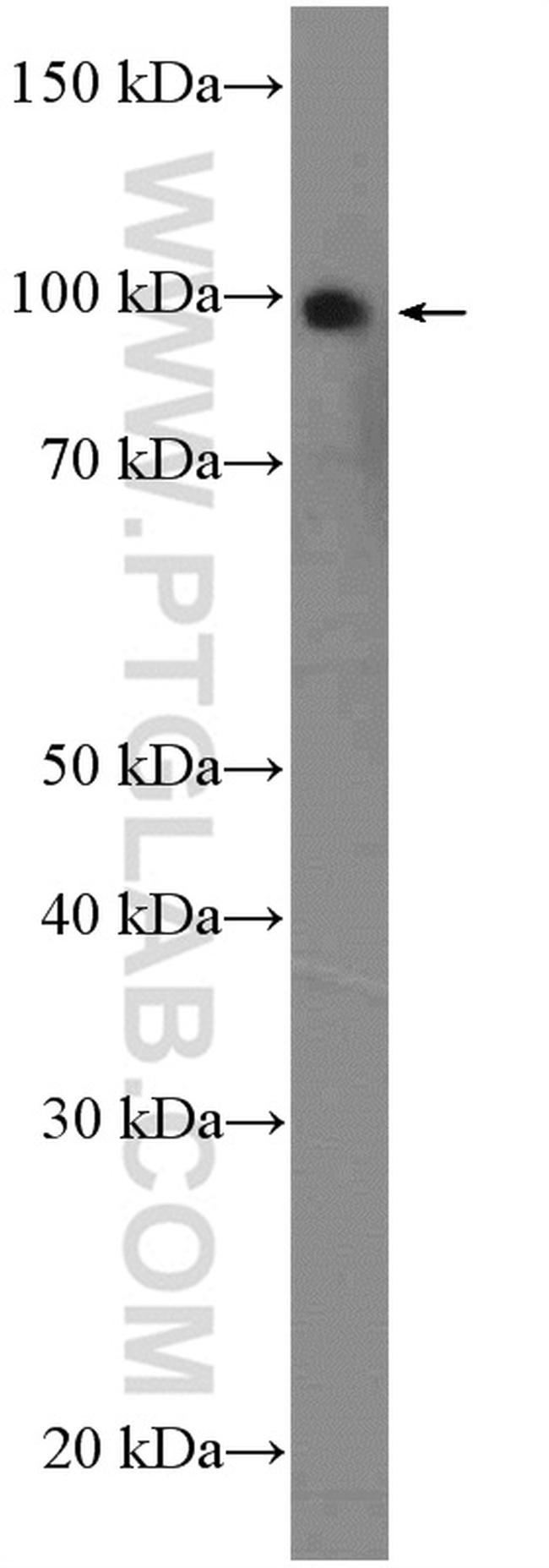 C1orf107 Antibody in Western Blot (WB)