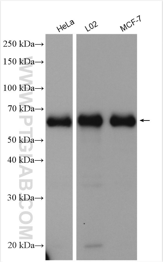 ACBD5 Antibody in Western Blot (WB)
