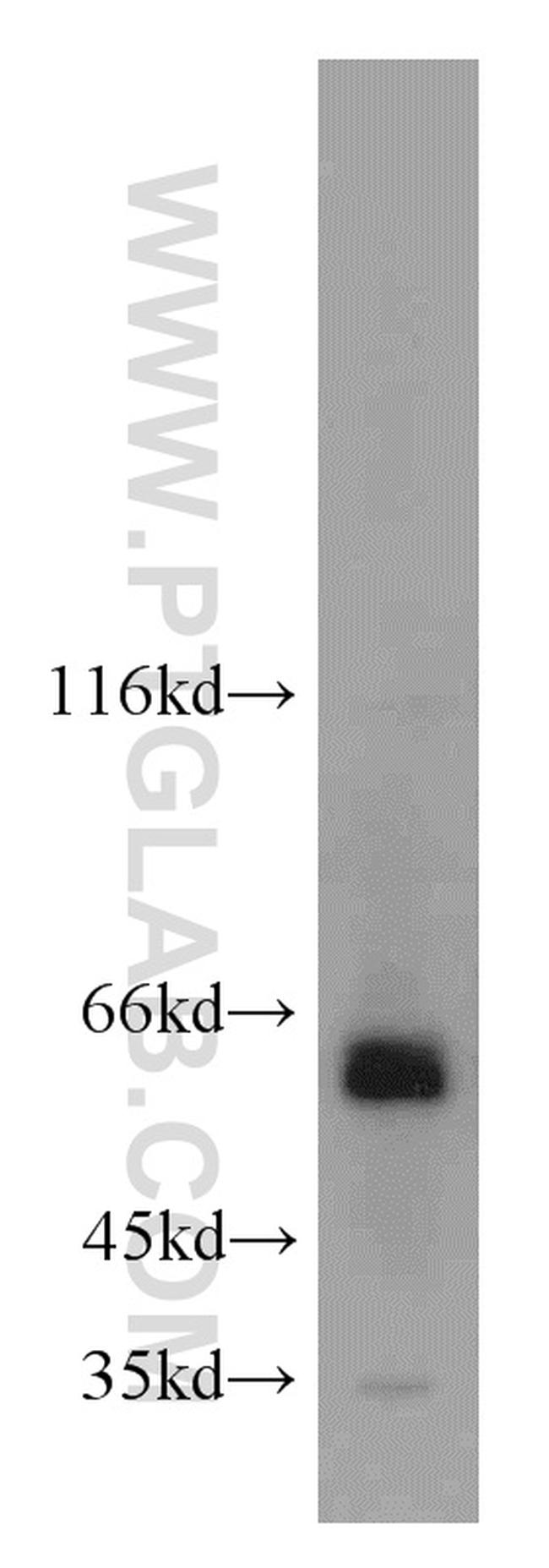 ACBD5 Antibody in Western Blot (WB)