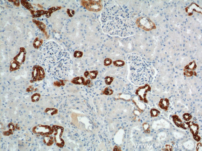 GPRC5D Antibody in Immunohistochemistry (Paraffin) (IHC (P))