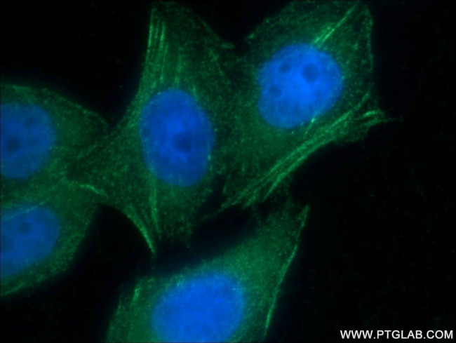 AFAP1 Antibody in Immunocytochemistry (ICC/IF)