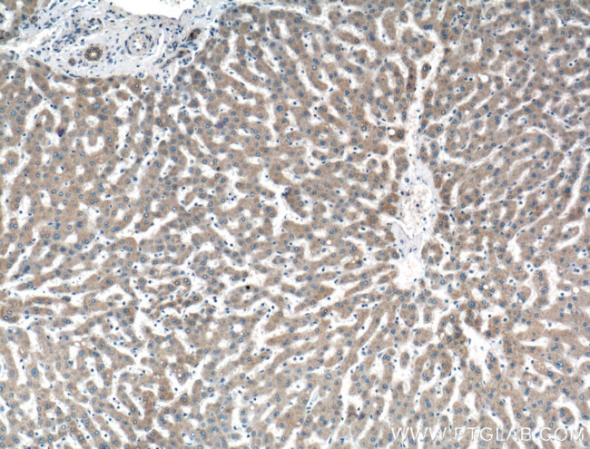 PRAS40 Antibody in Immunohistochemistry (Paraffin) (IHC (P))