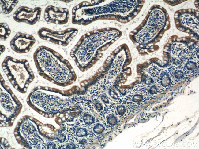 C1orf51 Antibody in Immunohistochemistry (Paraffin) (IHC (P))