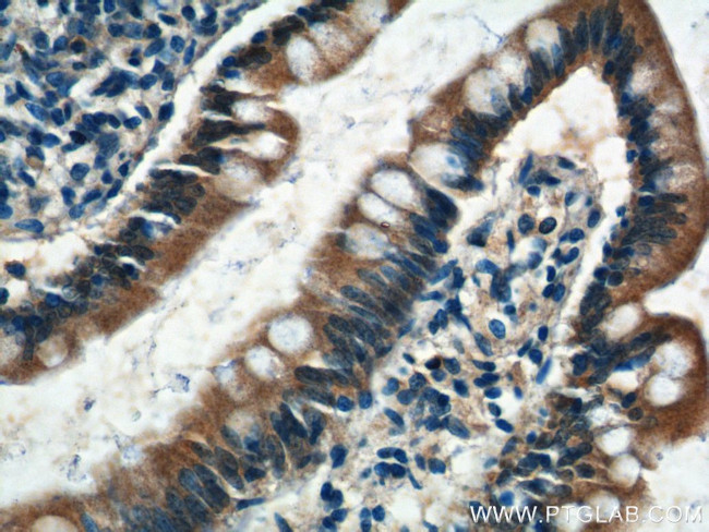 C1orf51 Antibody in Immunohistochemistry (Paraffin) (IHC (P))