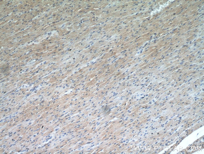 RANBP10 Antibody in Immunohistochemistry (Paraffin) (IHC (P))