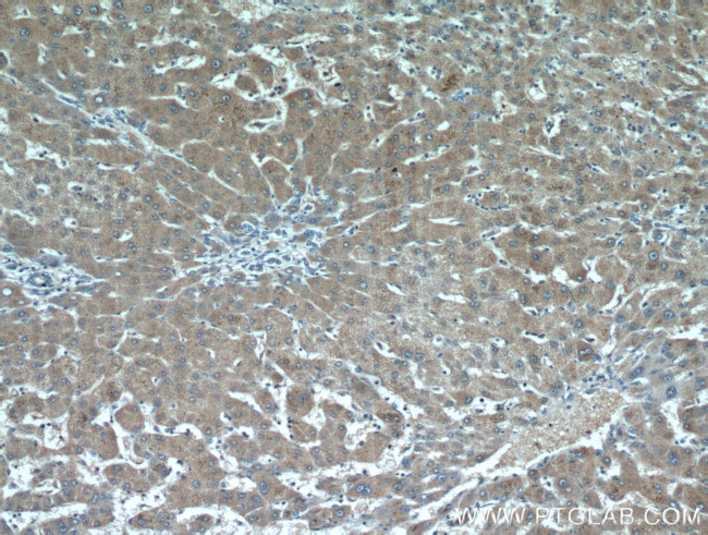 RANBP10 Antibody in Immunohistochemistry (Paraffin) (IHC (P))