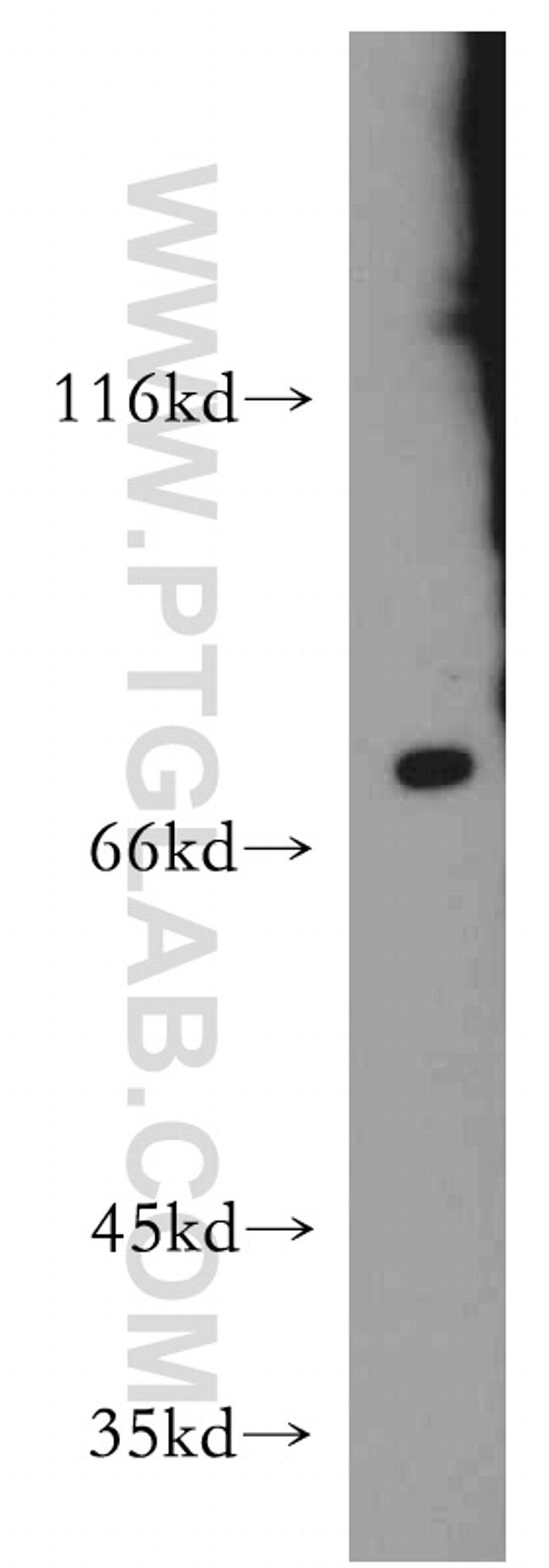 RANBP10 Antibody in Western Blot (WB)