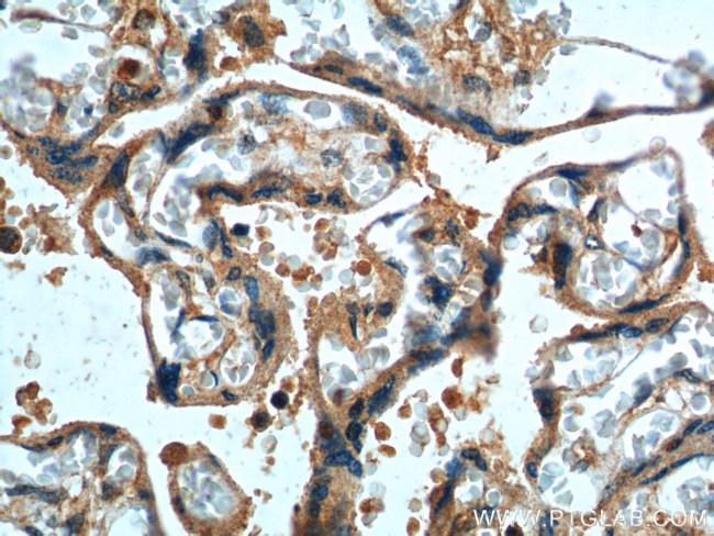 DKK1 Antibody in Immunohistochemistry (Paraffin) (IHC (P))