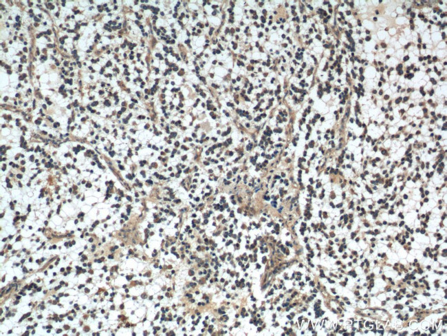 DKK1 Antibody in Immunohistochemistry (Paraffin) (IHC (P))