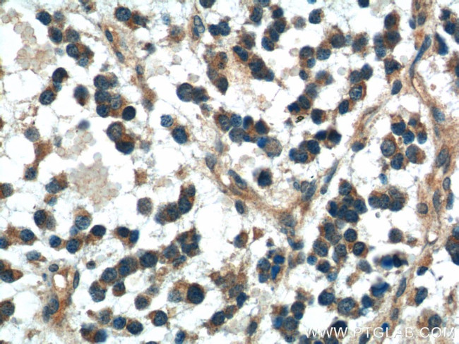 DKK1 Antibody in Immunohistochemistry (Paraffin) (IHC (P))