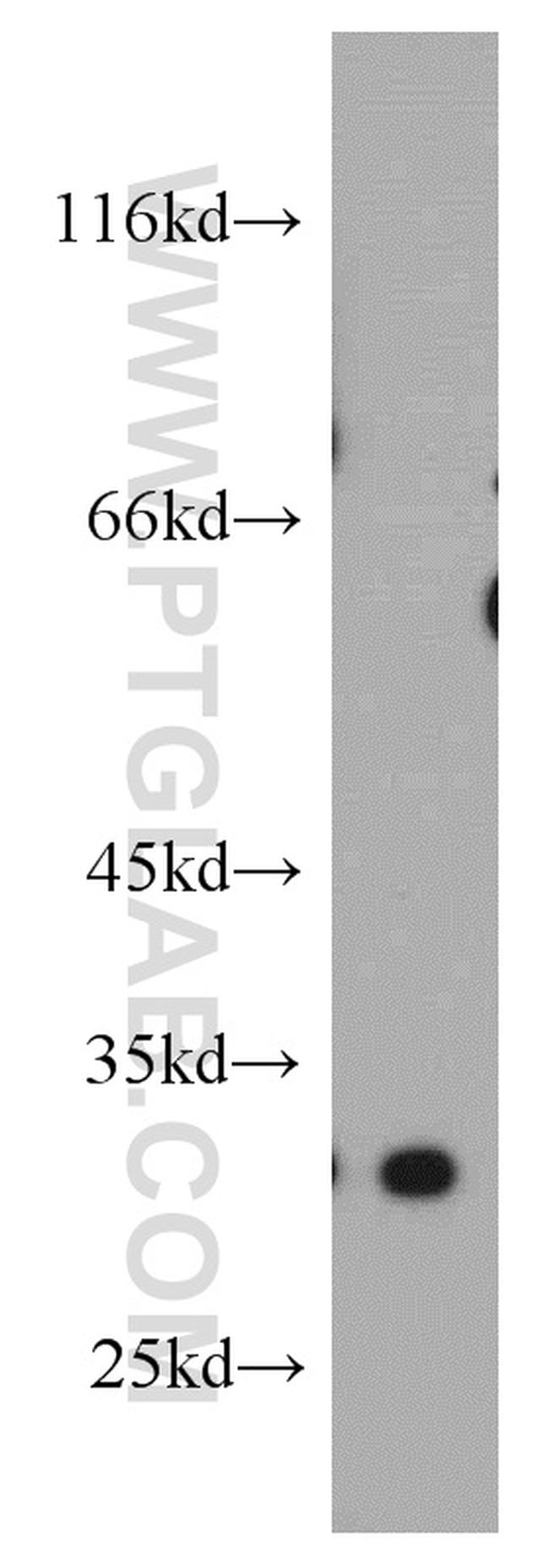 DKK1 Antibody in Western Blot (WB)