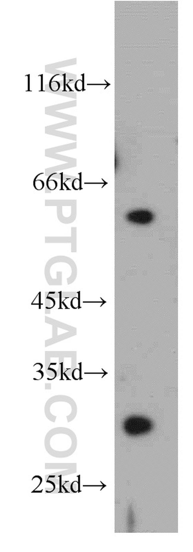 DKK1 Antibody in Western Blot (WB)