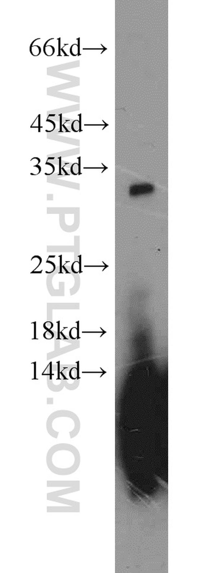 DKK1 Antibody in Western Blot (WB)