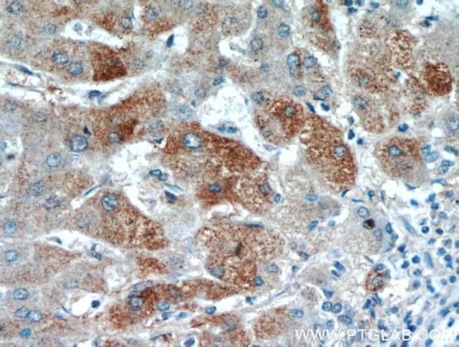 FAM101A Antibody in Immunohistochemistry (Paraffin) (IHC (P))