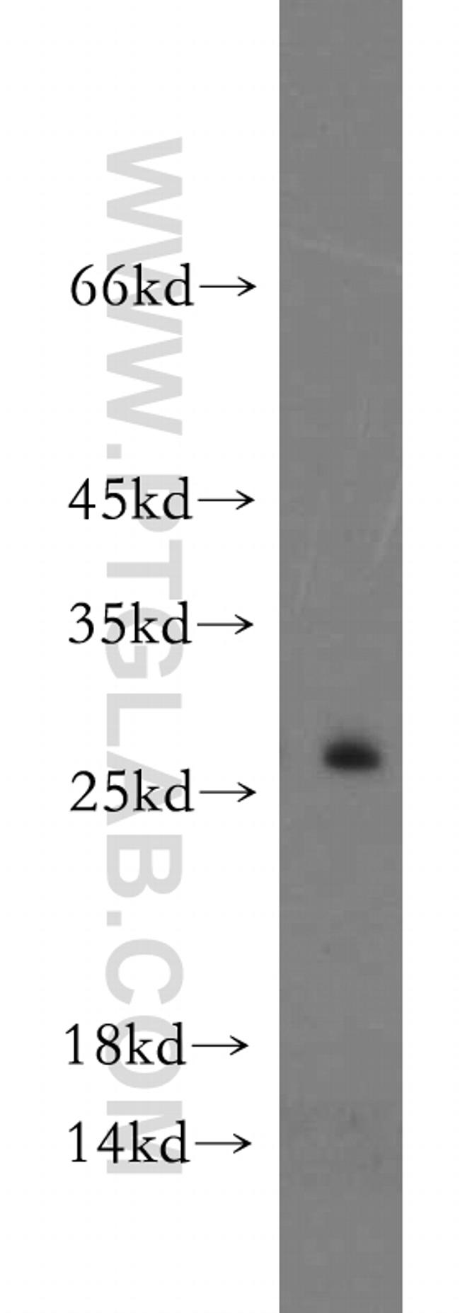 FAM101A Antibody in Western Blot (WB)