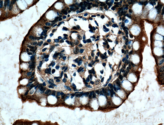 ACE2 Antibody in Immunohistochemistry (Paraffin) (IHC (P))