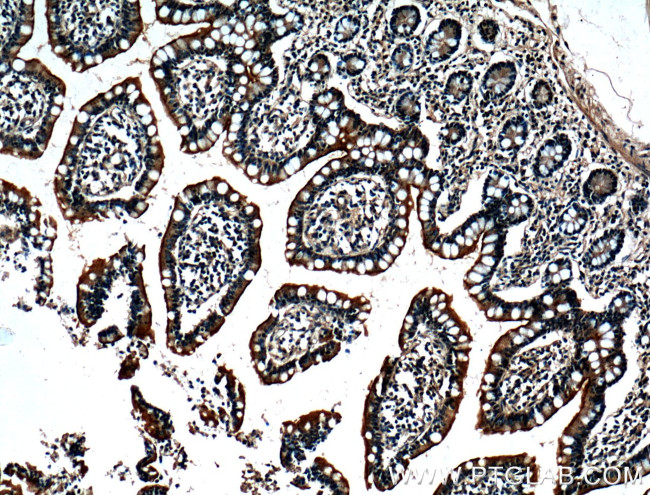 ACE2 Antibody in Immunohistochemistry (Paraffin) (IHC (P))