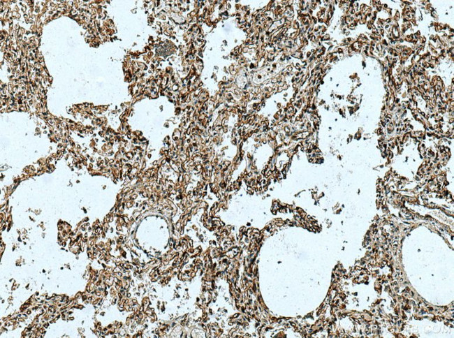 ACE2 Antibody in Immunohistochemistry (Paraffin) (IHC (P))